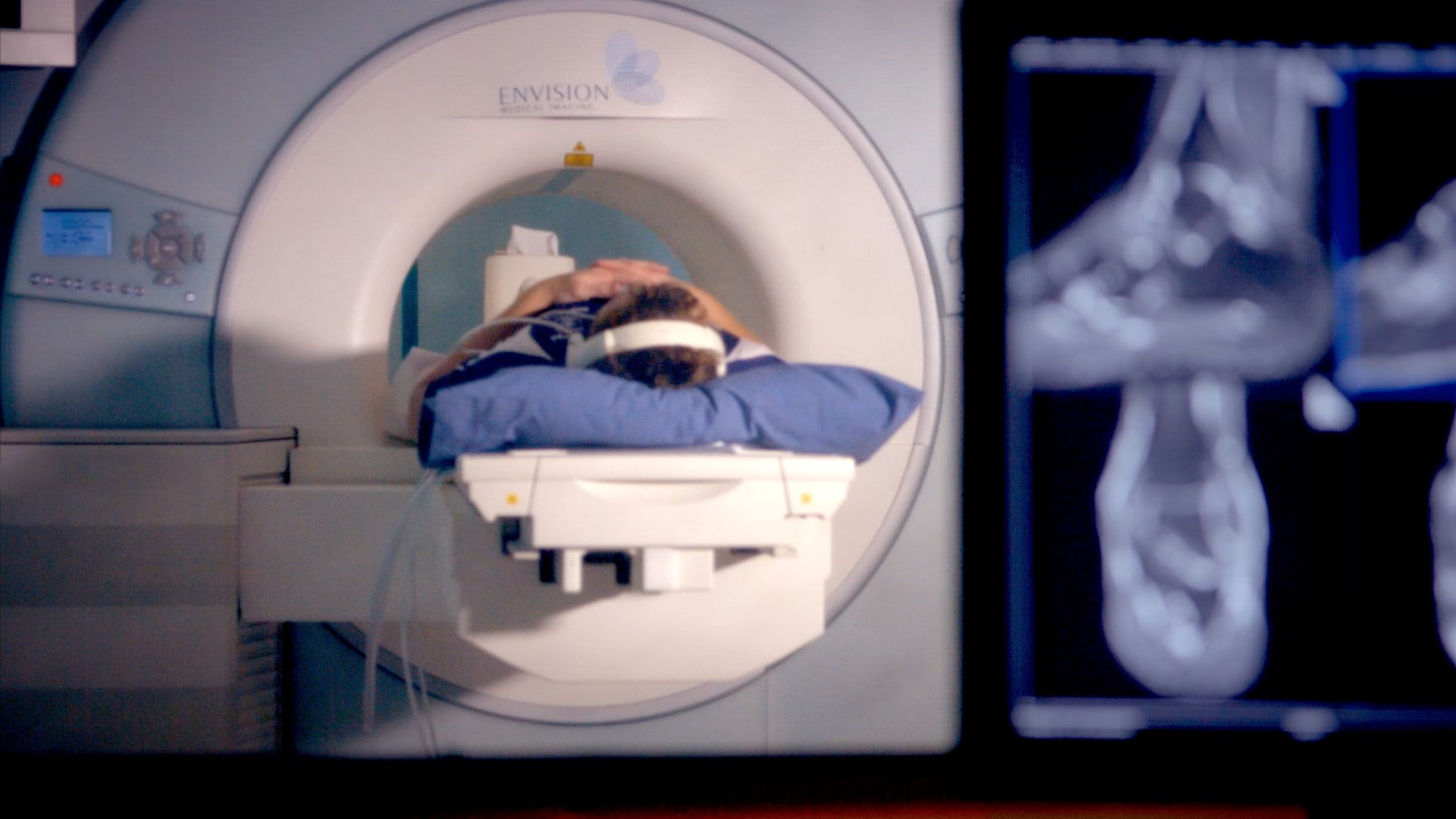 Envision MRI scan