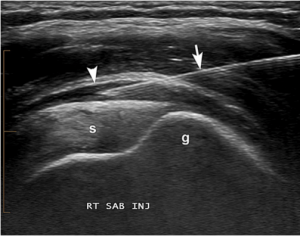 Ultrasound-Injection-scan